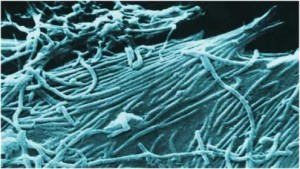 Wissenschaftler hoffen auf Durchbruch beim Ebola-Virus