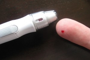 Vermeidbare Amputationen bei 50 Prozent aller Diabetiker