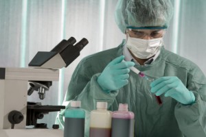 Neuer Urintest warnt vor Blasenkrebs