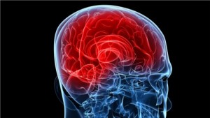 Hirnstimulationstechniken bei schweren Erkrankungen des Gehirns