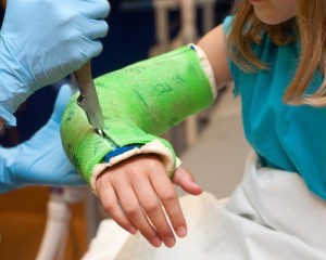 Linkshänder: Arm im Gips verändert Hirn in 16 Tagen