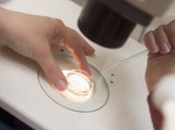 Krebszellen eines Tumors zeigen unterschiedliches Gen-Profil Krebszellen eines Tumors zeigen unterschiedliches Gen-Profil