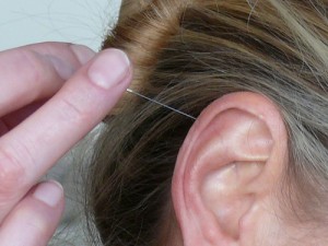 Neue Ansätze in der Tinnitus-Behandlung?