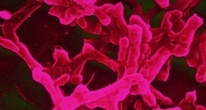 Jeder zweite Hähnchenschenkel enthält zu viele Keime
